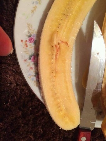 Bananlardakı qan ləkələri bakterial xəstəlik imiş - RƏSMİ