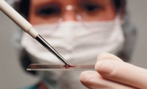 Hepatit C-yə yoluxanların sayı artıb