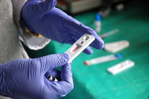 Rusiya şəhərində HİV epidemiyası: hər 50-ci sakin yoluxub