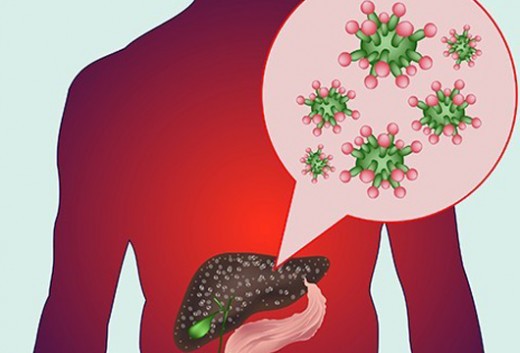 Hepatit B və C ilə bağlı QORXUNC STATİSTİKA