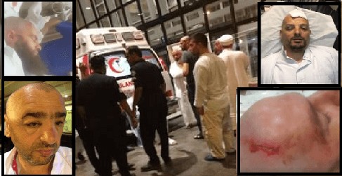 Türkiyəli zəvvarlar Məkkədə bir-birinə girdi: Yaralılar var
