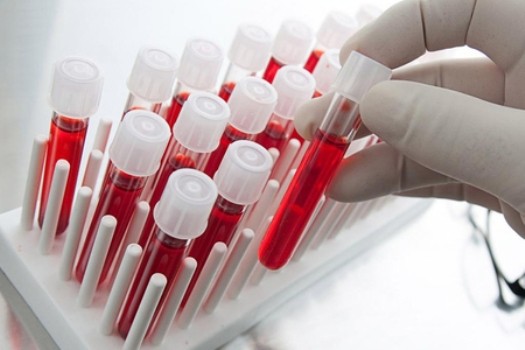 Ötən il Azərbaycanda hepatit B və C virusundan ölənlərin sayı açıqlanıb