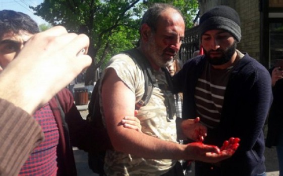 Polis erməni deputatı döyüb xəstəxanalıq etdi - FOTO