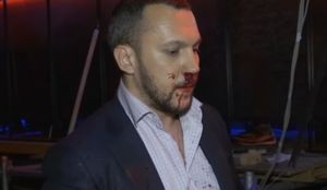 Deputatlar əlbəyaxa oldular