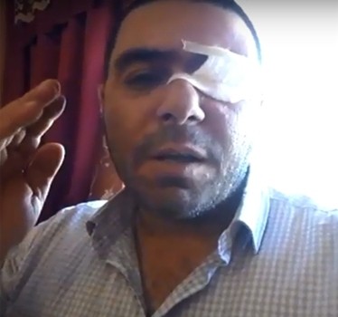 “Cənab Ali Baş Komandan, döyüş əmri ver!” - Qarabağ qazisi Prezidentə müraciət etdi