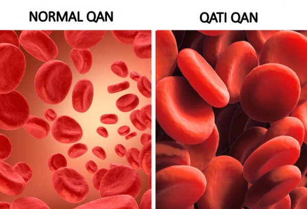 Qanı qatılaşdıran 5 içki – Ürəyi xəstə olanlar ehtiyatlı olmalıdır!