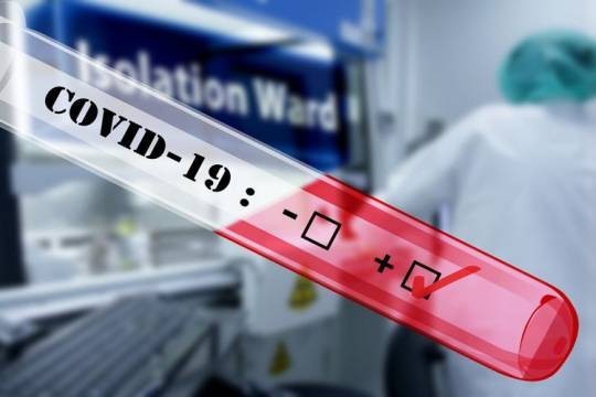 Xankəndində koronavirus dünən 4 can aldı - Qondarma rejim səksəkədə