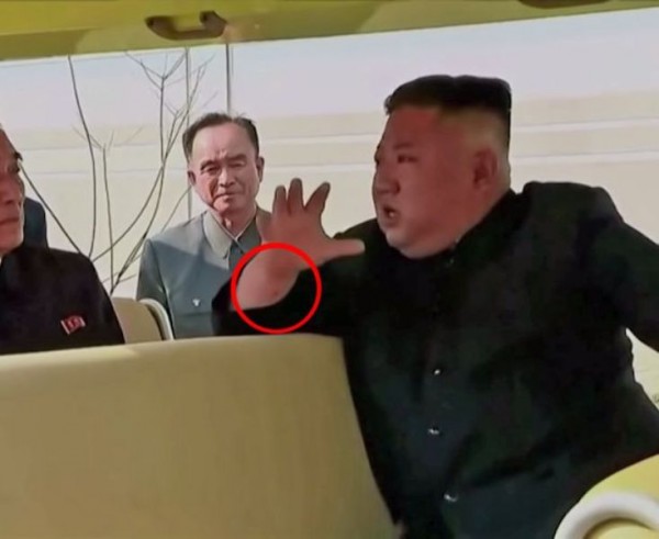 Kim Çen Inın əlində müəmmalı iz tapıldı — FOTO