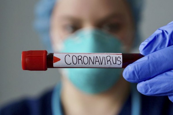 Azərbaycanda daha bir vəzifəli şəxs koronavirusa yoluxub