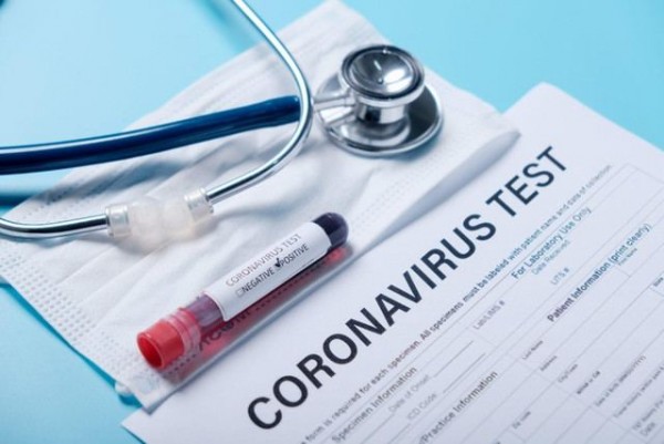 COVİD-19 testinin cavabı gecikən şəxslər nə etməlidir? - AÇIQLAMA