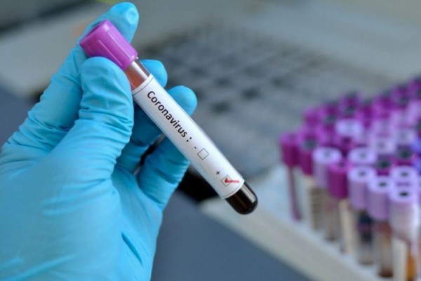 Dünyada virusa yoluxanların statistikası