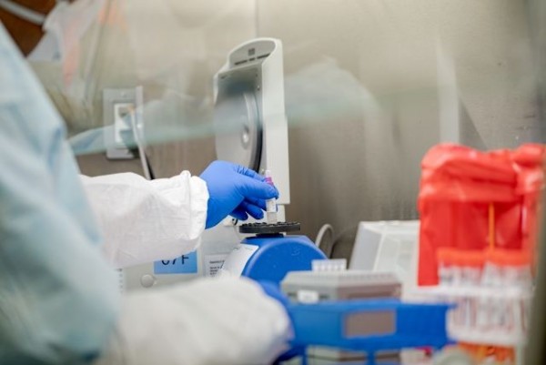 İtaliya korona ilə bağlı yeni növ test hazırlandı - 3 dəqiqəyə...