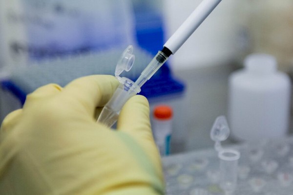 Azərbaycanda son sutkada koronavirusun statistikası