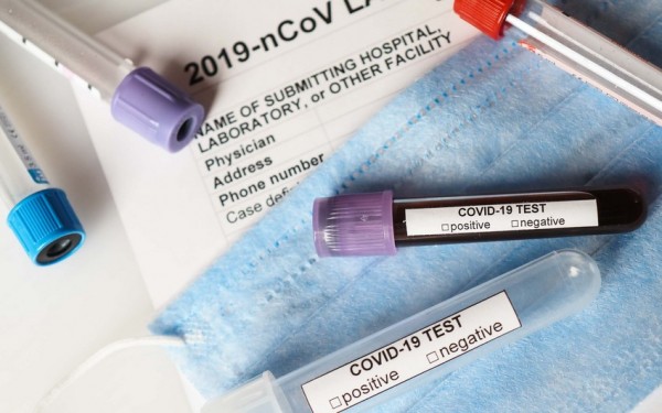 Azərbaycanda simptomsuz şəxslərdən COVID-19 testi götürülməsi dayandırıldı - SƏBƏB