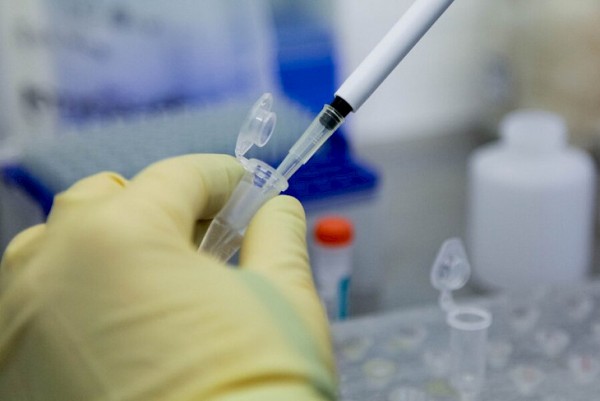 Azərbaycanda daha 9 nəfər koronavirusdan öldü