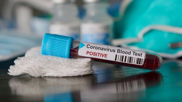Koronavirus peyvəndi vurulan şəxs öldü