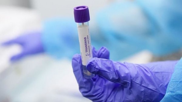 Azərbaycanda son sutkada koronavirusa yoluxanların sayı açıqlandı