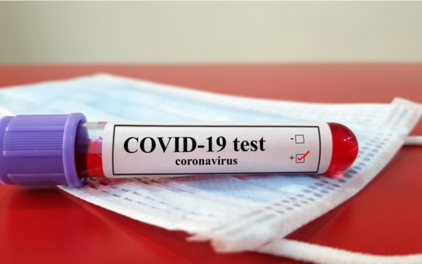 Koronavirus bir gündə 7,8 mindən çox insanın həyatına son qoydu - Statistika