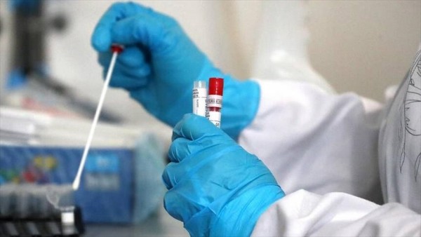 Bakıda koronavirusa yoluxma ən çox bu rayonda qeydə alınıb - Statistika