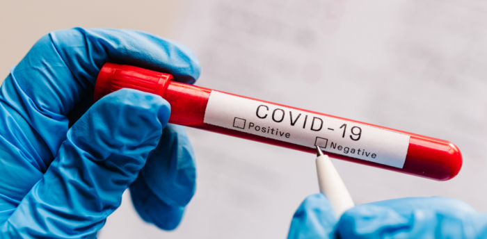 Azərbaycanda koronavirusa yoluxanların sayı azaldı -  Statistika Azərbaycanda koronavirusa yoluxanların sayı azaldı -  Statistika