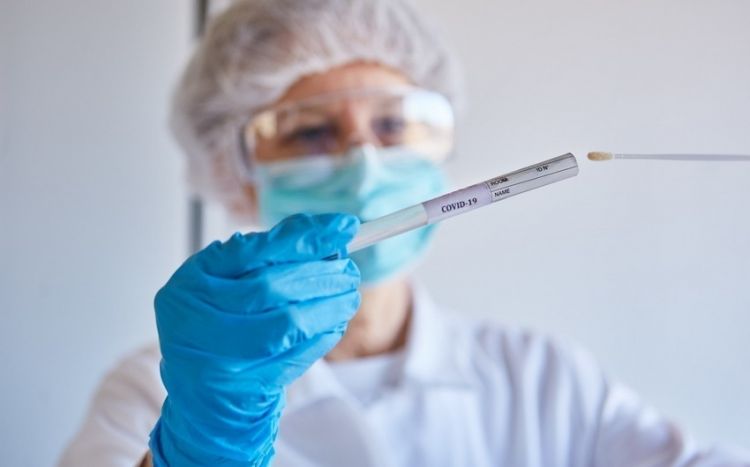 Azərbaycanda daha 29 nəfər koronavirusun qurbanı olub