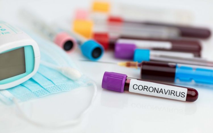 Azərbaycanda bu gün 11 nəfər koronavirusdan vəfat edib -  Statistika