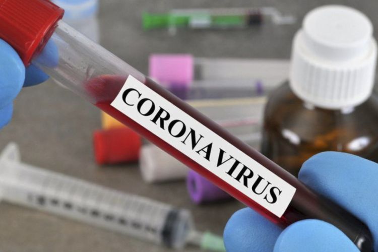 Azərbaycanda son sutkada koronavirusa yoluxanların  statistikası