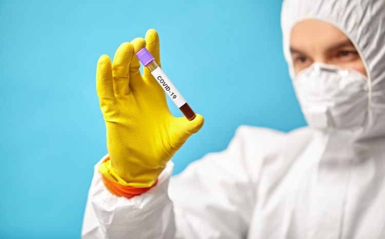 Azərbaycanda son sutkada koronavirusdan ölüm qeydə alınmayıb
