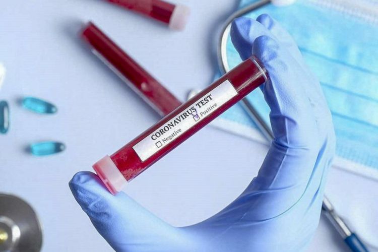 Rusiyada koronavirusun “Delta” ştammının yeni variantı olan AY.4.2 aşkarlanıb