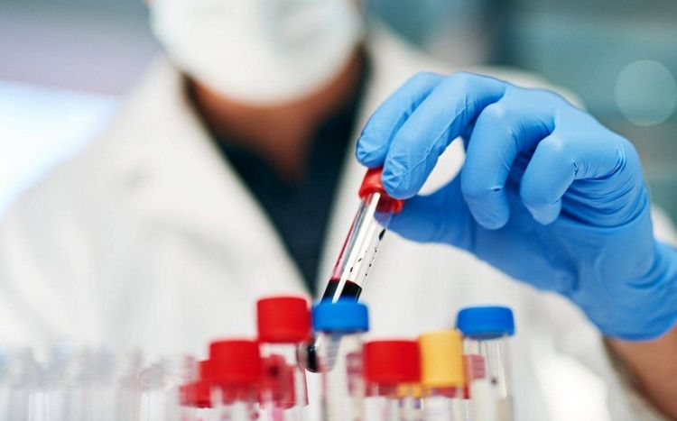 Azərbaycanda 674 nəfər COVID-19-a yoluxub, 10 nəfər vəfat edib Azərbaycanda 674 nəfər COVID-19-a yoluxub, 10 nəfər vəfat edib