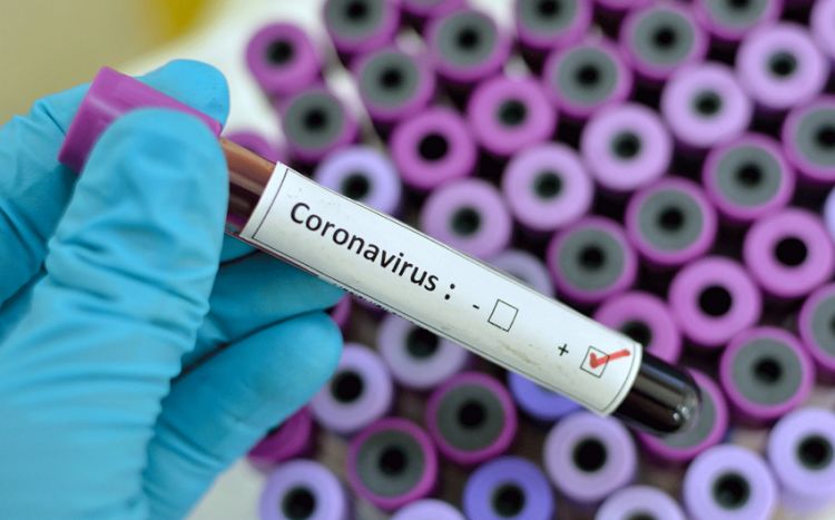 Azərbaycanda koronavirusa yoluxan və ölənlərin sayı açıqlandı