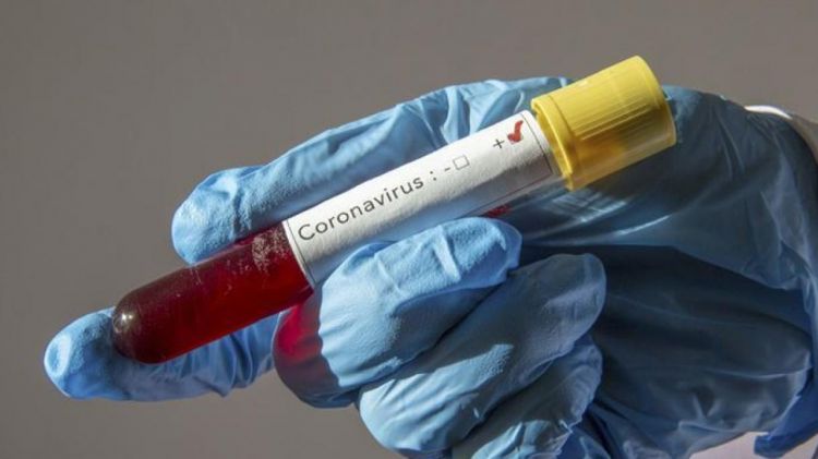 Azərbaycanda daha 3 564 nəfər koronavirusa yoluxub