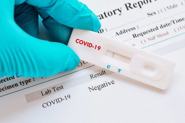 Apteklərdə satılan koronavirus testləri nə dərəcədə etibarlıdır? -  TƏBİB açıqladı