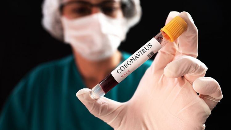 Ölkədə son sutkada koronavirusa yoluxanların  SAYI