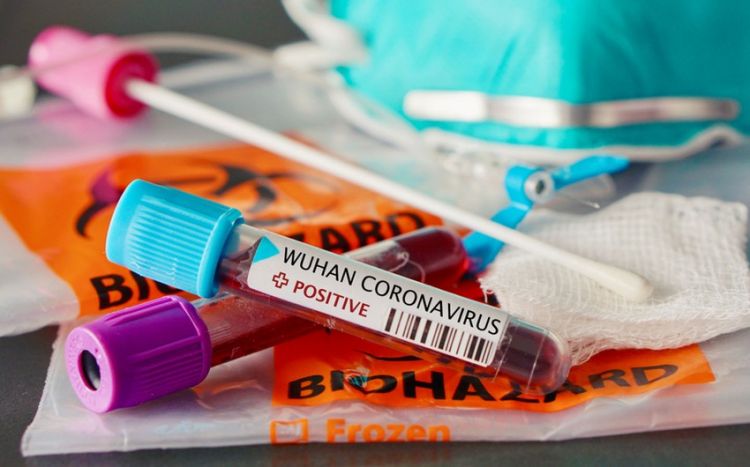 Ölkədə son sutkada koronavirusdan 1 nəfər ölüb