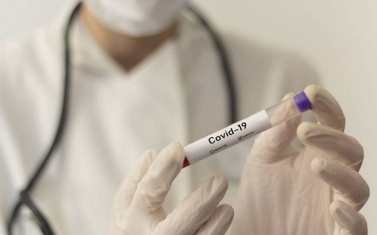 Azərbaycana giriş üçün COVID-19-a dair PCR testi tələbi ləğv olunub