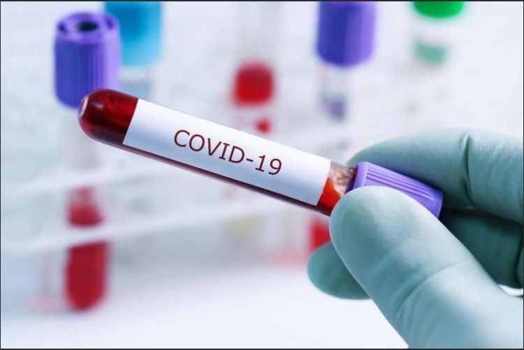 Ölkədə 8 nəfər koronavirusa yoluxub