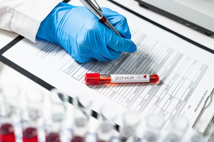 Son sutkada koronaya yoluxanların sayı açıqlandı