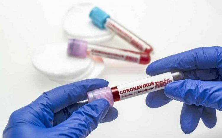 "Koronavirus pandemiyasının sonu yaxınlaşır" - ÜST açıqladı