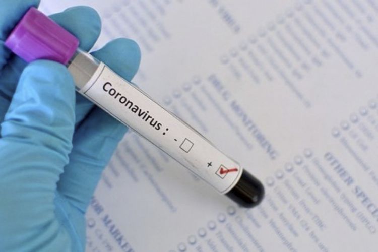 Son sutkada  koronavirusdan 2 nəfər ölüb