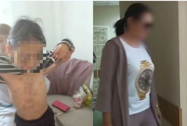 Ögey qızına dəhşətli işgəncələr verən qadına 4 il həbs cəzası verildi Ögey qızına dəhşətli işgəncələr verən qadına 4 il həbs cəzası verildi