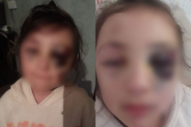 Məktəblinin döyülməsi iddiaları ilə bağlı araşdırmalara başlanıldı - VİDEO - YENİLƏNİB Məktəblinin döyülməsi iddiaları ilə bağlı araşdırmalara başlanıldı - VİDEO - YENİLƏNİB