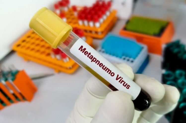 Metapnevmovirus pnevmoniyaya çevrilə bilər