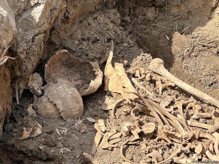 Ağdamda insan sümüyü fraqmentləri aşkarlandı