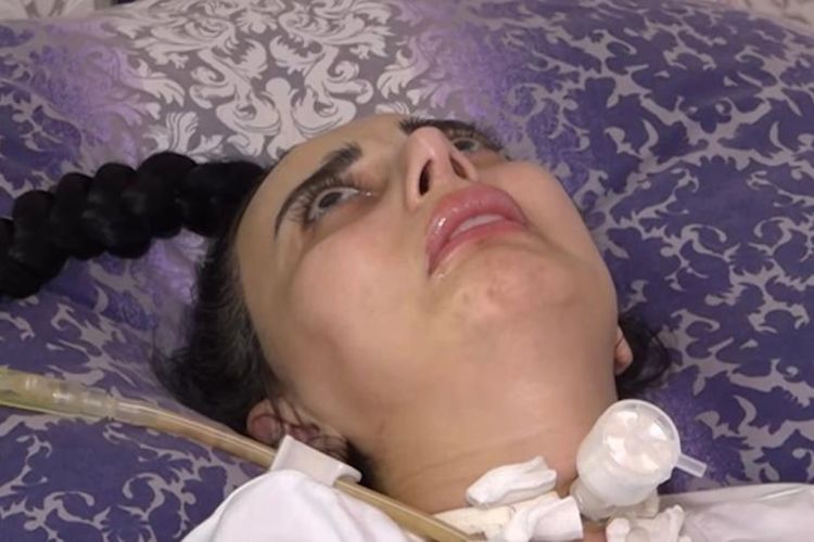 Burun əməliyyatına sağlam girib iflic olaraq çıxdı: Cərrah isə aparatın işləmədiyini deyir - VİDEO