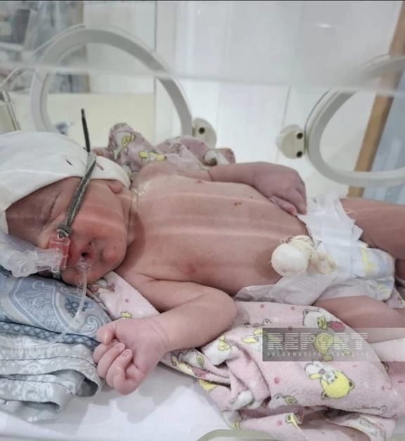 Azərbaycanda 2026-cı ilin ilk körpəsi dünyaya gəlib - FOTO