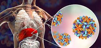 Azərbaycanda hepatit B virusuna yoluxanların sayı kəskin azalıb
