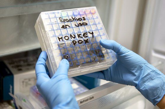 Taylanddan qayıdan iki rusiyada meymunçiçəyi aşkar edilib