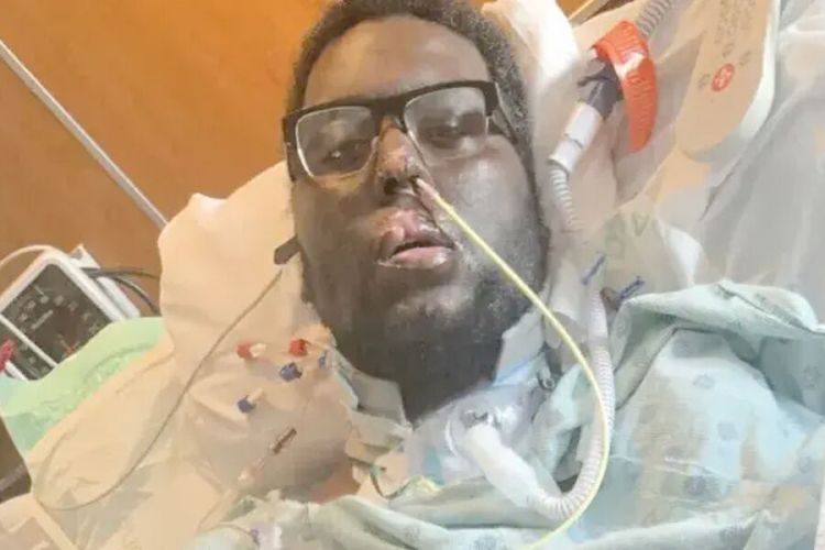 Adi diş müayinəsi həyatı bahasına başa gəldi: Komaya düşdü, əzalarını itirdi