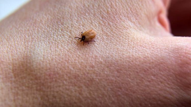 Türkiyədə kişi gənə dişləməsindən öldü